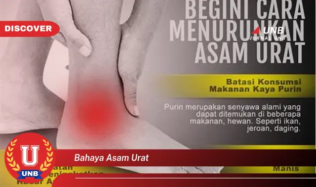 bahaya asam urat