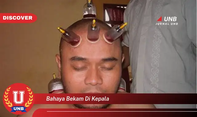bahaya bekam di kepala bahaya bekam di kepala