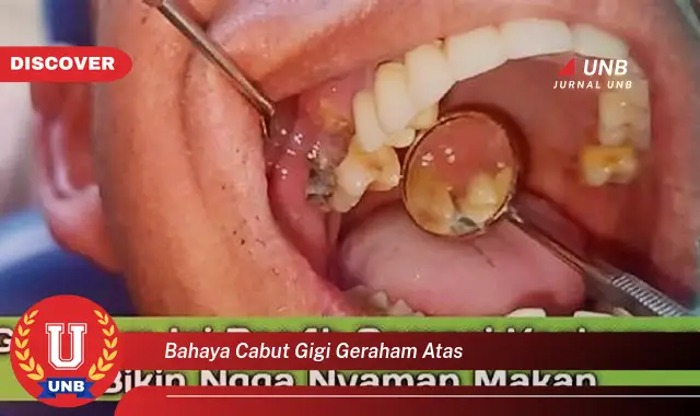 bahaya cabut gigi geraham atas