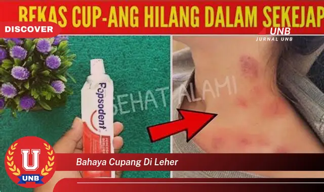 bahaya cupang di leher bahaya cupang di leher