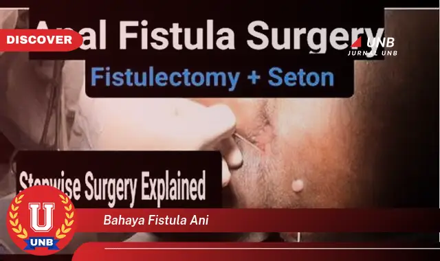 bahaya fistula ani bahaya fistula ani