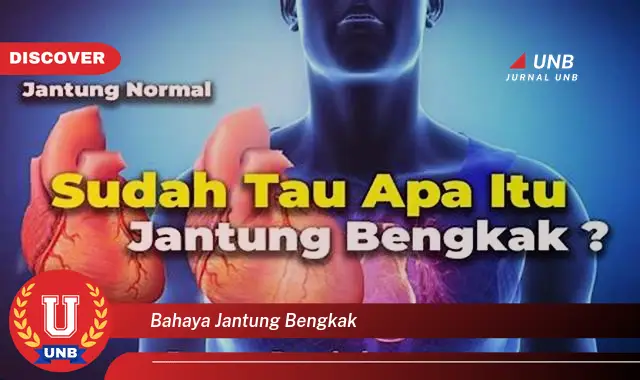 bahaya jantung bengkak bahaya jantung bengkak
