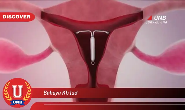 bahaya kb iud
