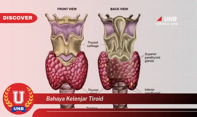 bahaya kelenjar tiroid