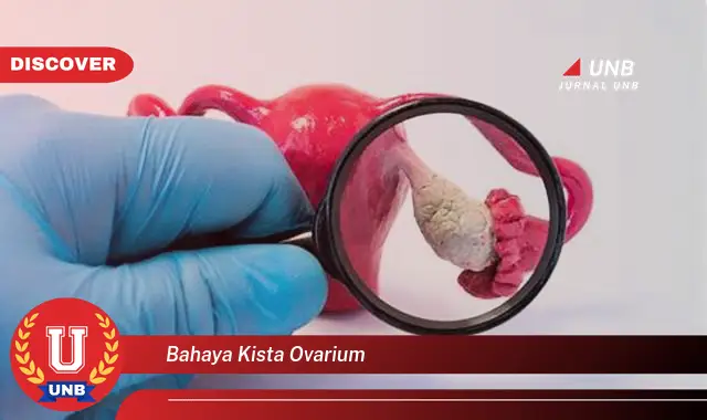 bahaya kista ovarium bahaya kista ovarium