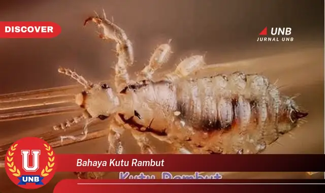 bahaya kutu rambut bahaya kutu rambut