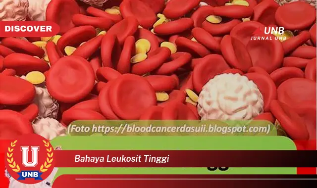 bahaya leukosit tinggi bahaya leukosit tinggi