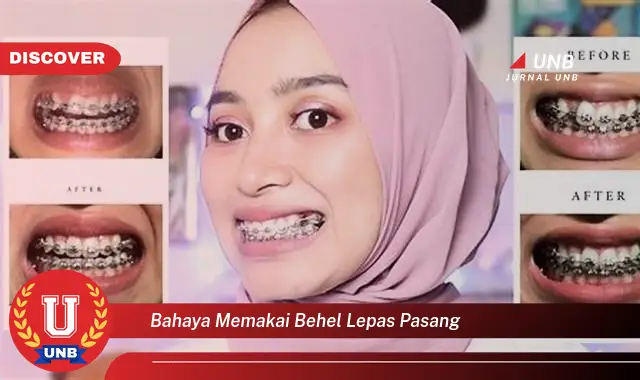 bahaya memakai behel lepas pasang bahaya memakai behel lepas pasang