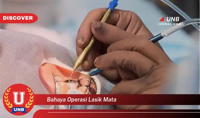 bahaya operasi lasik mata