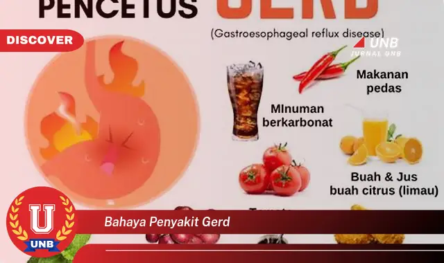 bahaya penyakit gerd bahaya penyakit gerd