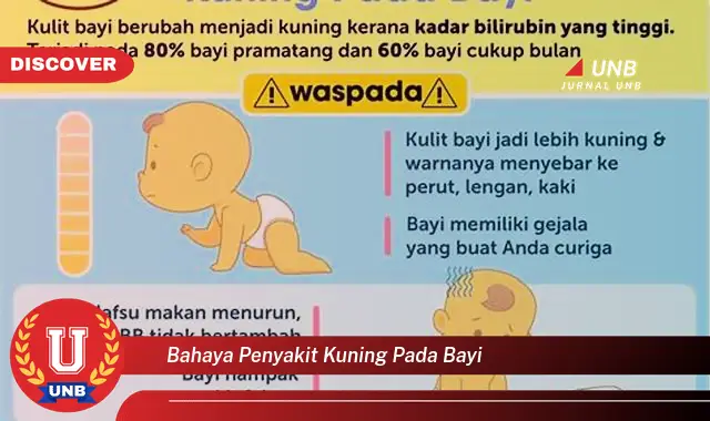 bahaya penyakit kuning pada bayi