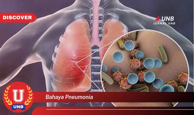 bahaya pneumonia bahaya pneumonia