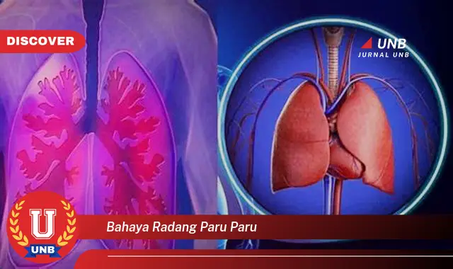 bahaya radang paru paru bahaya radang paru paru