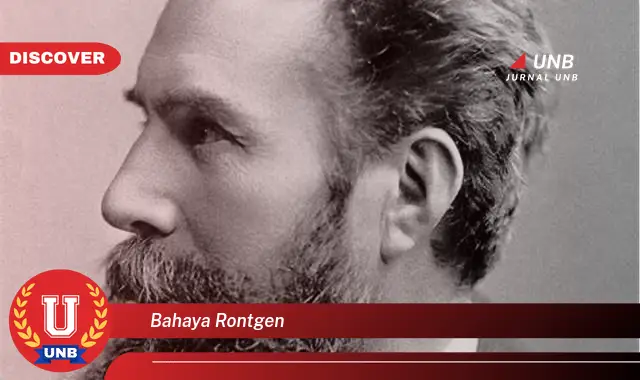 bahaya rontgen