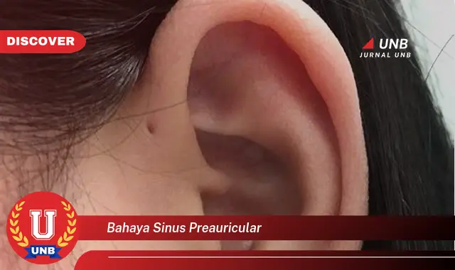 bahaya sinus preauricular