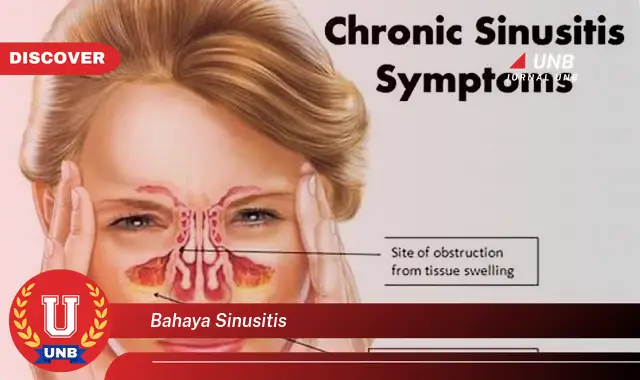 bahaya sinusitis