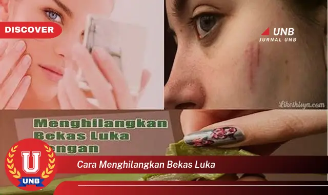 cara menghilangkan bekas luka