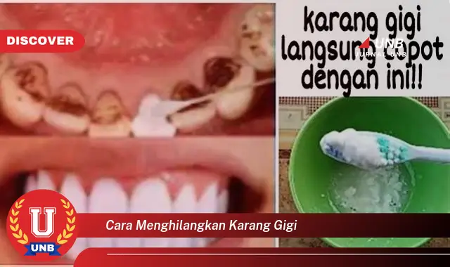 cara menghilangkan karang gigi