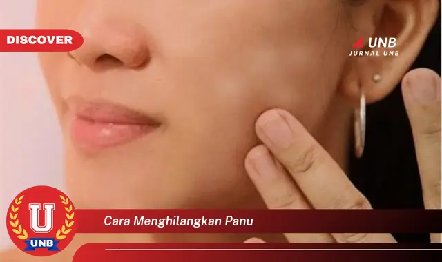 cara menghilangkan panu