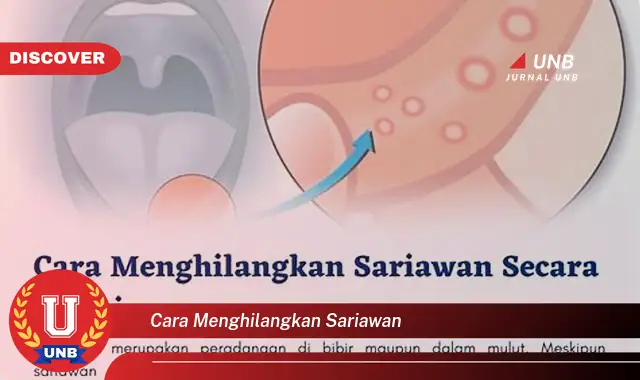 cara menghilangkan sariawan