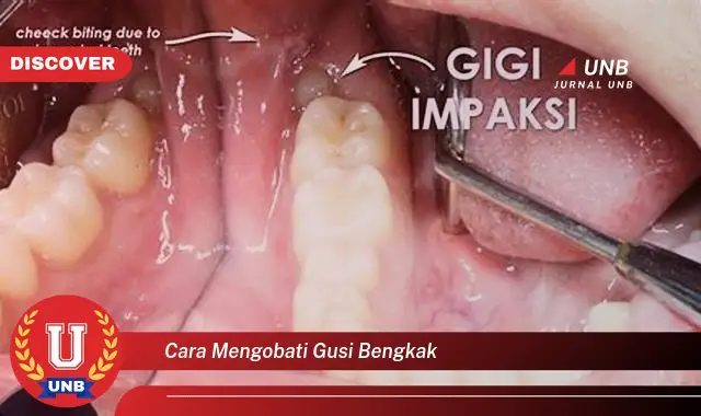 cara mengobati gusi bengkak