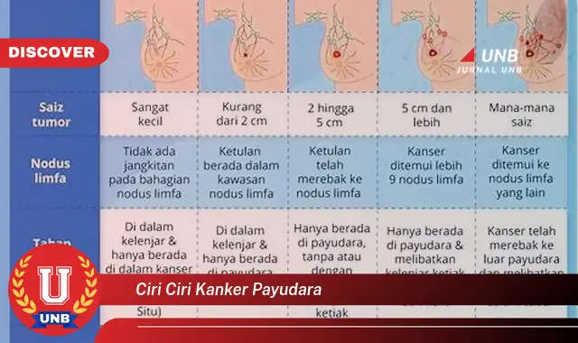 ciri ciri kanker payudara