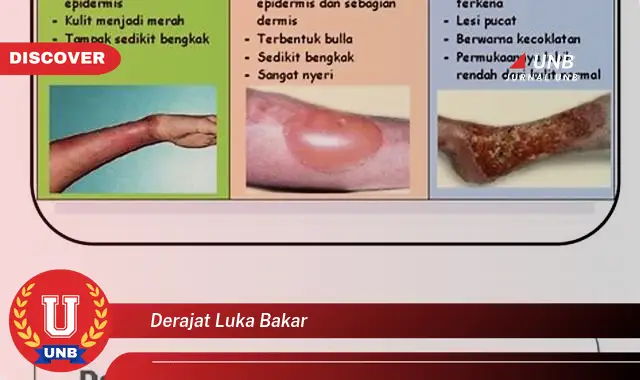 derajat luka bakar