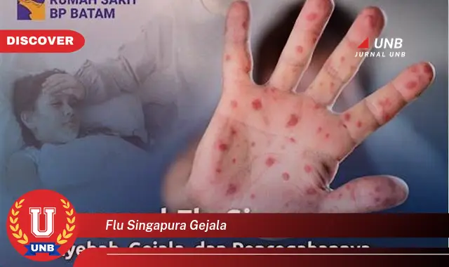 flu singapura gejala