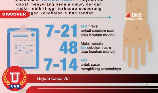 gejala cacar air