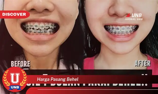 harga pasang behel