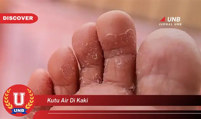 kutu air di kaki