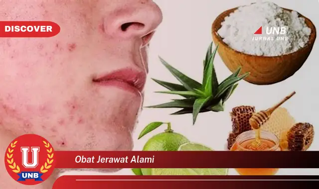 obat jerawat alami