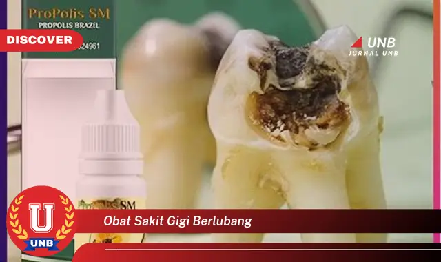 obat sakit gigi berlubang