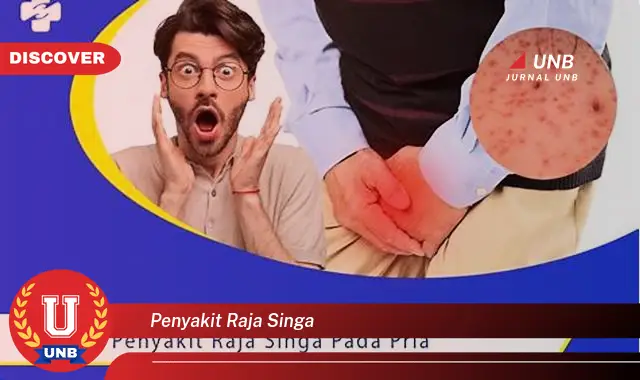 penyakit raja singa