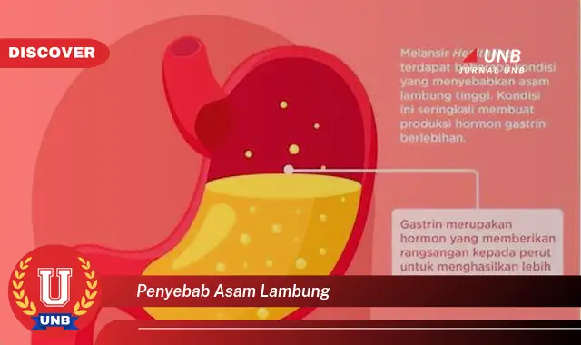 penyebab asam lambung