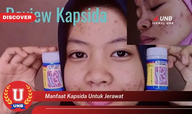 manfaat kapsida untuk jerawat