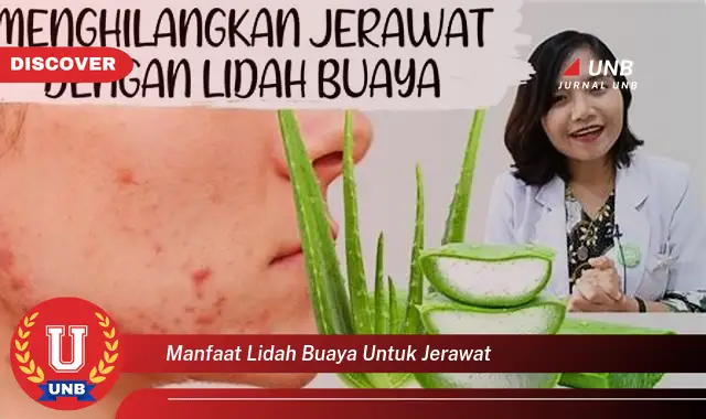 manfaat lidah buaya untuk jerawat