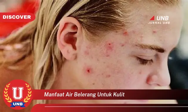 manfaat air belerang untuk kulit