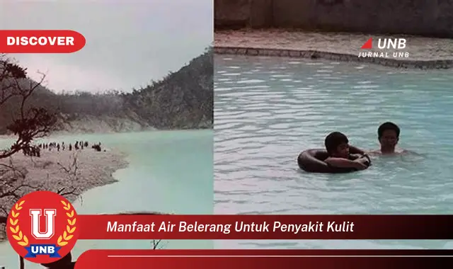 manfaat air belerang untuk penyakit kulit manfaat air belerang untuk penyakit kulit