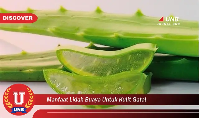 Intip 6 Manfaat Lidah Buaya untuk Kulit Gatal yang Wajib Kamu Tahu