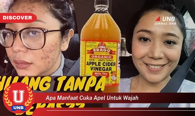 apa manfaat cuka apel untuk wajah apa manfaat cuka apel untuk wajah