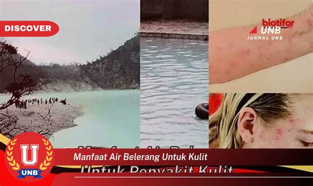 Temukan 9 Manfaat Air Belerang untuk Kulit, Atasi Masalah Kulit dan Raih Kulit Sehat Berseri Temukan 9 Manfaat Air Belerang untuk Kulit, Atasi Masalah Kulit dan Raih Kulit Sehat Berseri
