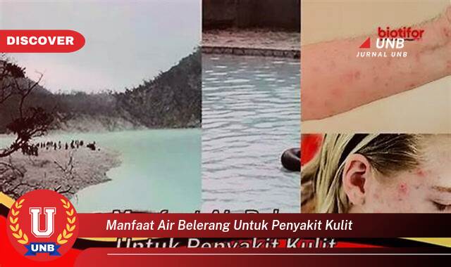Temukan 8 Manfaat manfaat air belerang untuk penyakit kulit yang Jarang Diketahui