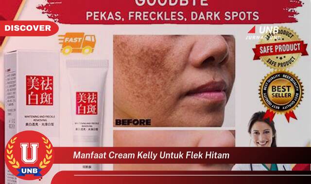 Temukan 9 Manfaat Cream Kelly untuk Menghilangkan Flek Hitam di Wajah Secara Efektif