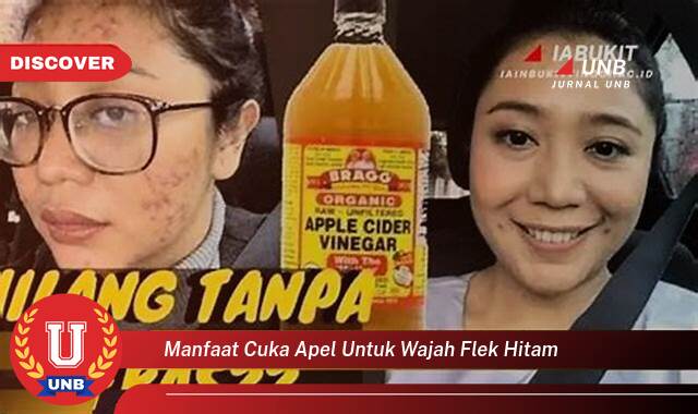 Temukan 8 Manfaat Cuka Apel untuk Menghilangkan Flek Hitam di Wajah Secara Alami Temukan 8 Manfaat Cuka Apel untuk Menghilangkan Flek Hitam di Wajah Secara Alami