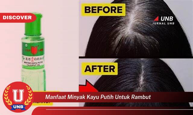 Temukan 10 Manfaat Minyak Kayu Putih untuk Rambut,  Atasi Ketombe,  Rangsang Pertumbuhan, dan Tips Penggunaan