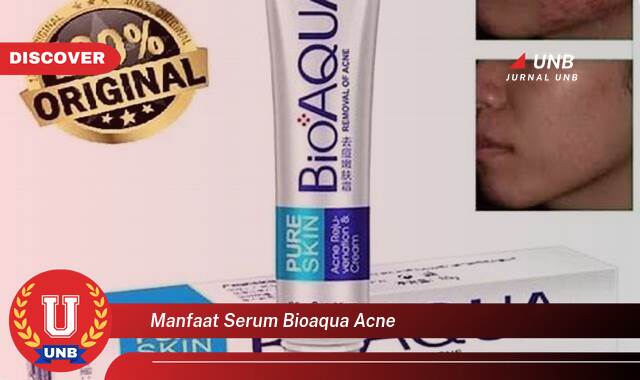 Temukan 8 Manfaat Serum Bioaqua Acne untuk Kulit Berjerawat dan Cara Pakainya